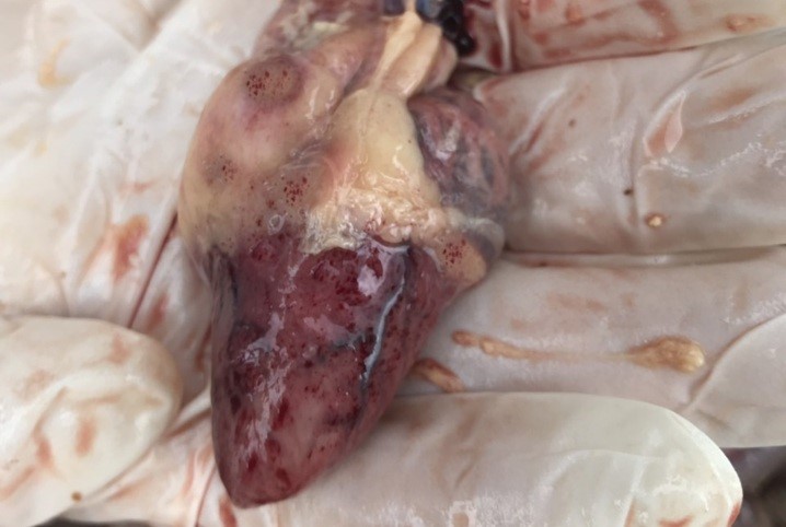 3 Mnozhynni krovovylyvy na sertsi