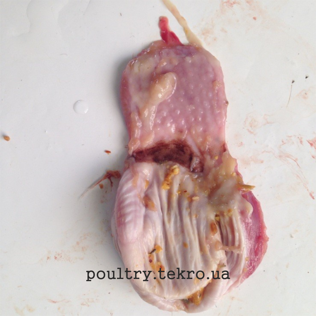 Кровотеча в слизовій оболонці залозистого шлунка Кровотеча в слизовій оболонці залозистого шлунка