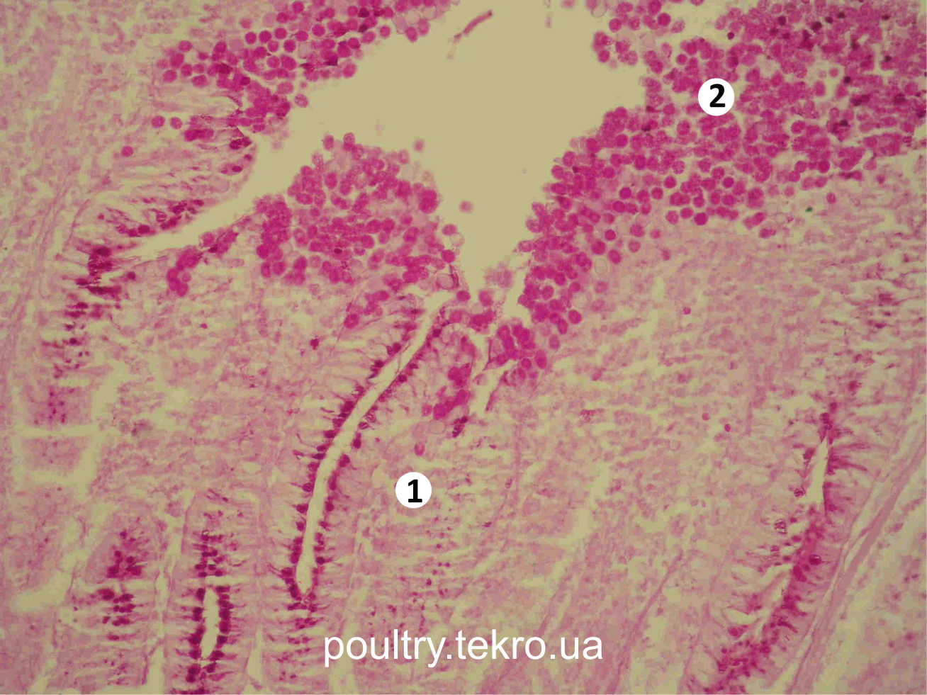 Сліпа кишка. Руйнування верхівок ворсинок (1), вихід ооцист у просвіт кишки (2). ШИК реакція. Х 200 Сліпа кишка. Руйнування верхівок ворсинок (1), вихід ооцист у просвіт кишки (2). ШИК реакція. Х 200