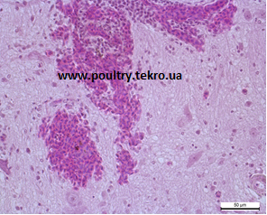 10 Dіapedeznі krovovilivi v rechovinu golovnogo mozku