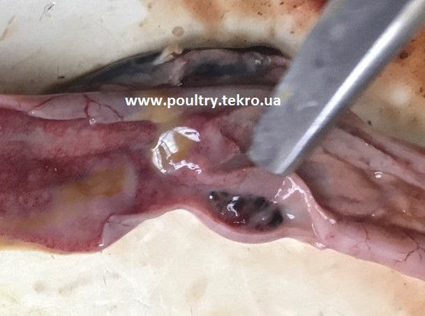 3 Krovovilivi u cekalnіj tonzilі