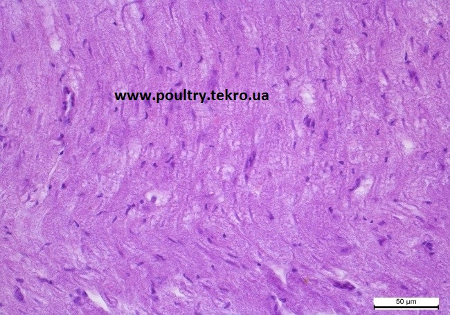 8 Nerv. Degenerativnі zmіni v periferichnih nervah u vigljadі vakuolno-glibchastoї distrofії