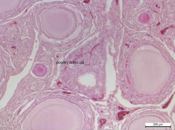 Atrofiya folikuliv ta proliferaciya u folikuli blastnyx klityn