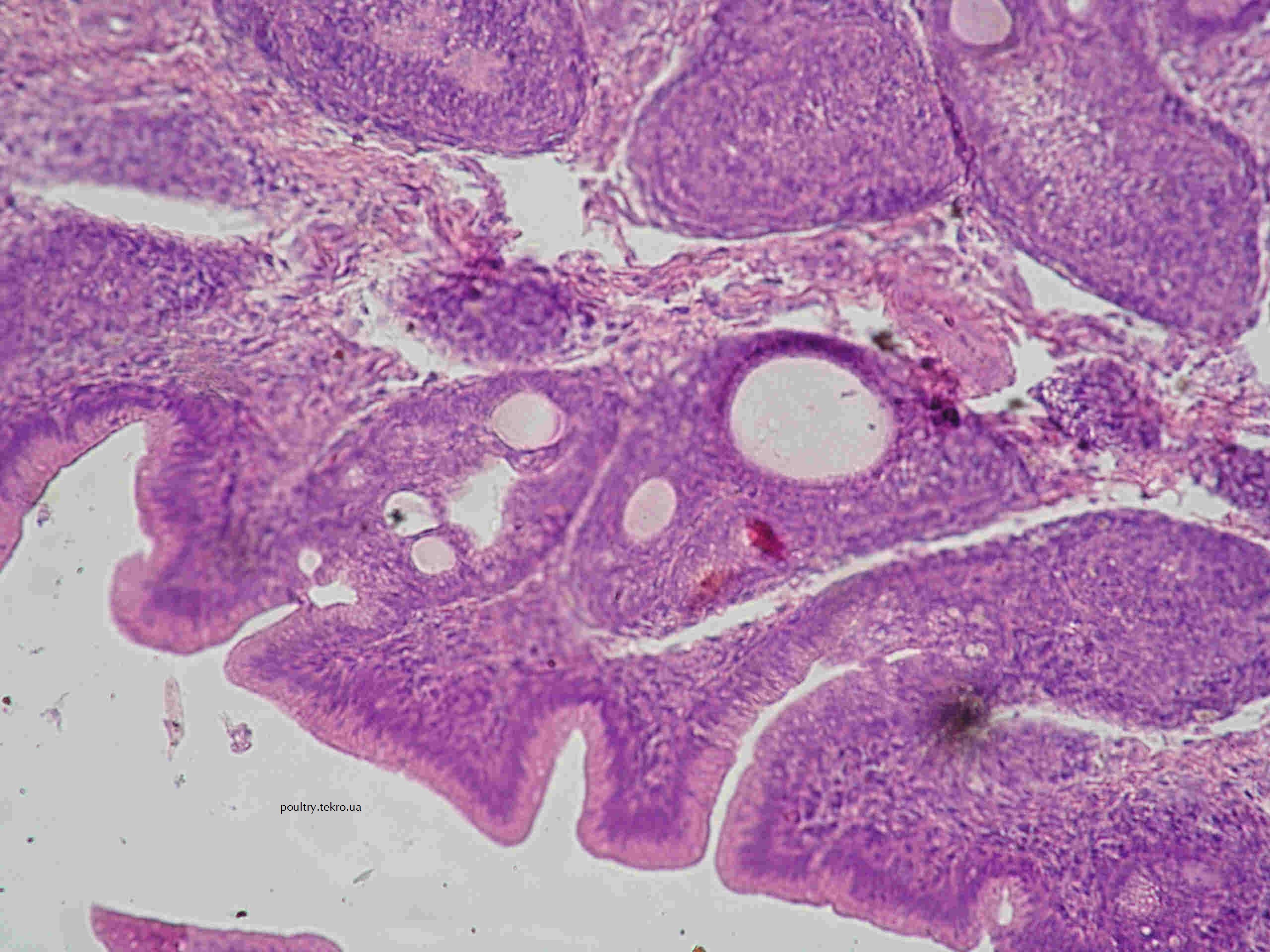 Nekrozy u centralnyx dilyankax limfoyidnyx vuzlykiv kloakalnoyi sumky