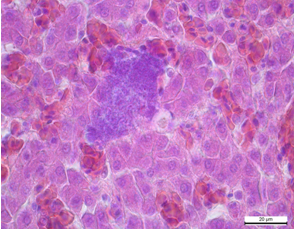 Pechіnka Kolonії mіkroorganіzmіv Gematoksilіn ta eozin