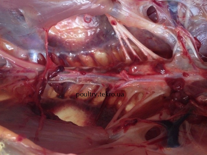 Potovshhennya poperekovo-kryzhovyx nerviv