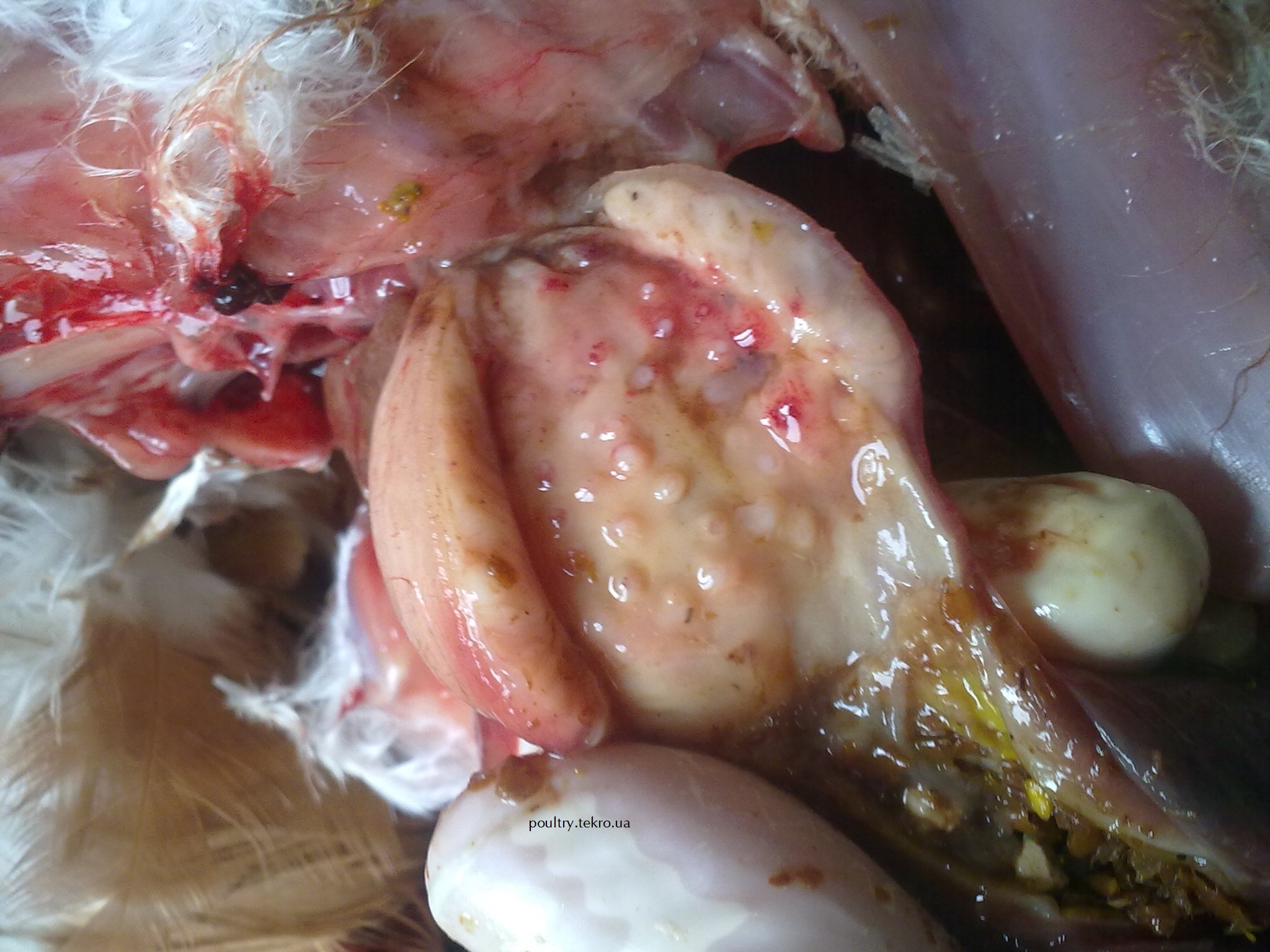 Potovshhennya stinky zalozystogo shlunka