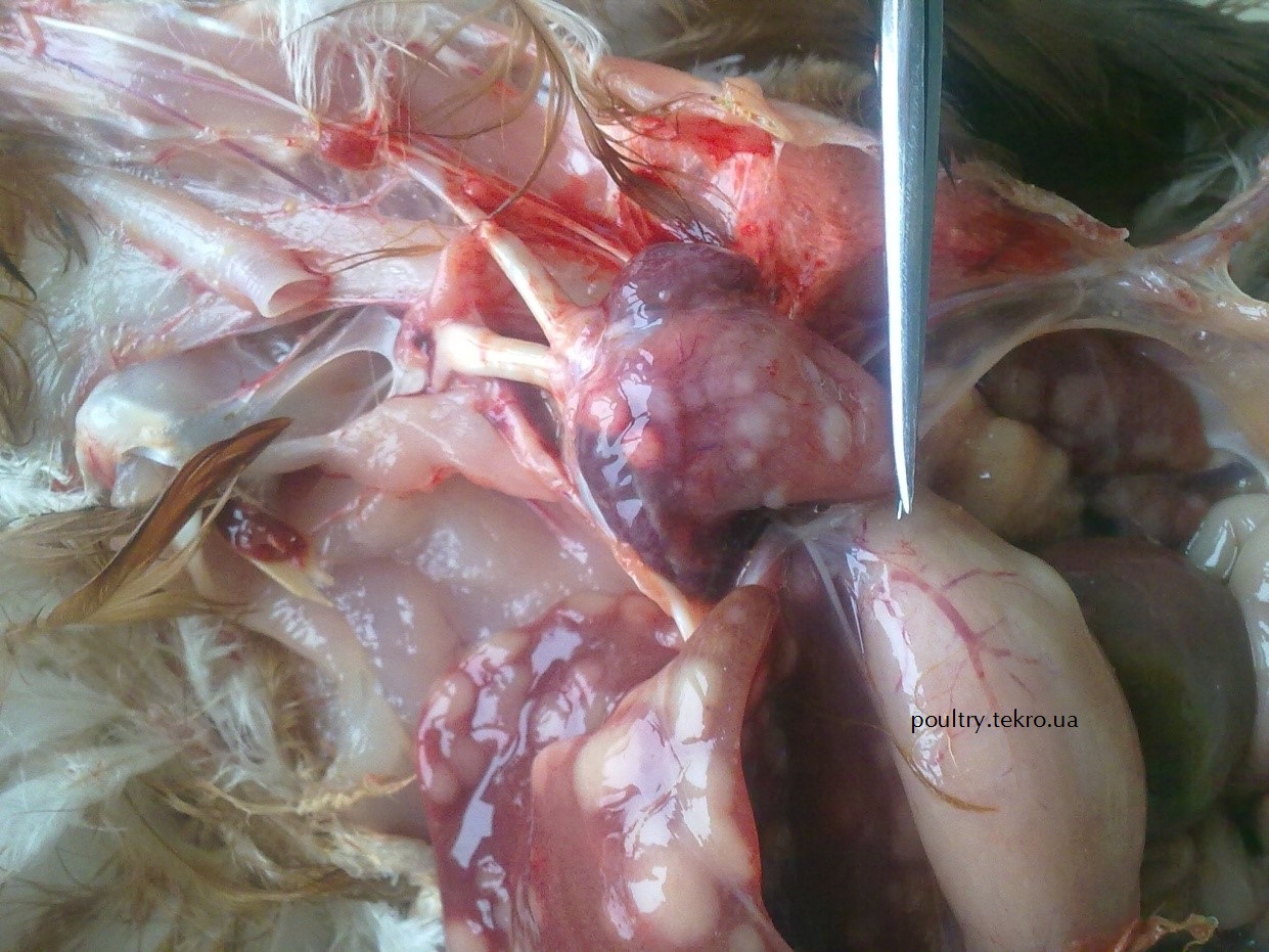 Puxlynni rozrostannya v serci