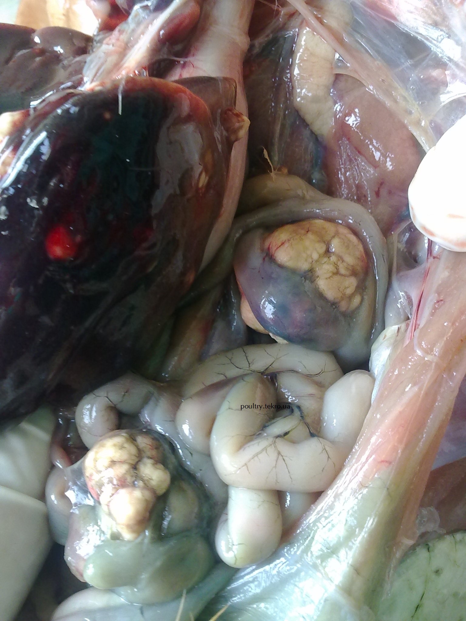 Puxlynni utvorennya na seroznyx pokryvax kyshechnyka