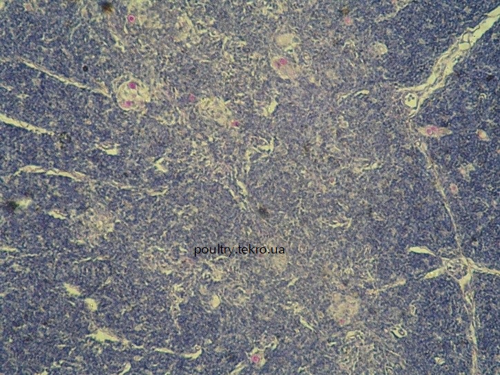 Timus. Іnversіja kіrkovogo ta mozkovogo sharіv pri іmunodefіcitі