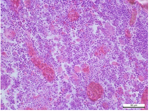 Timus Rozshirennja ta perepovnennja krovju sudin Gematoksilіn ta eozin