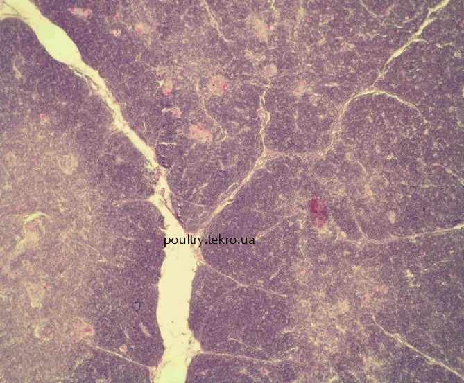 Тимуs. Zmenshennja kіrkovogo sharu timusa. Pojava znachnoї kіlkostі tіlec Gassalja