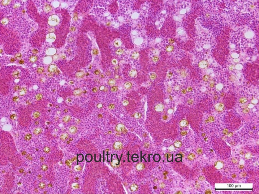 Кістковий мозок. Заміщення кровотворних клітин жировою тканиною. Гематоксилін та еозин х 400